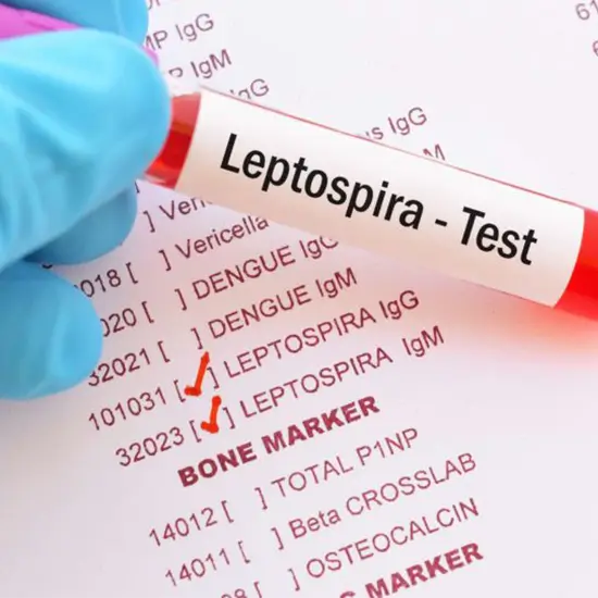 leptospira antibody igg test